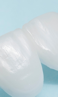 명동치과 라미네이트와 올세라믹의 차이점 관련 이미지 33