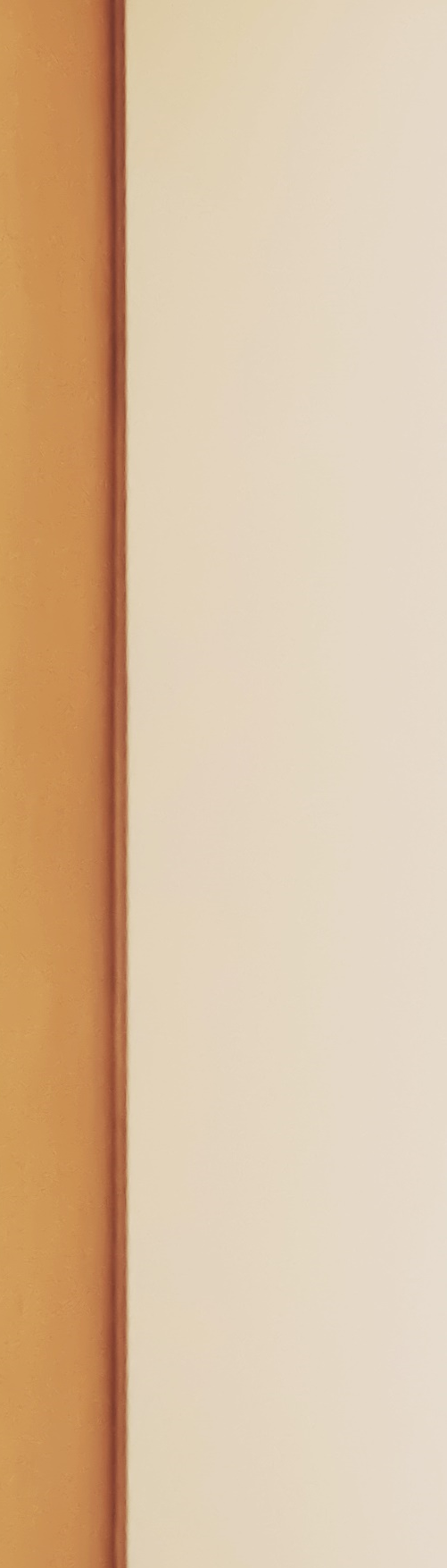 종각역 치과 점심시간에도 편하게 진료 보세요 관련 이미지 34