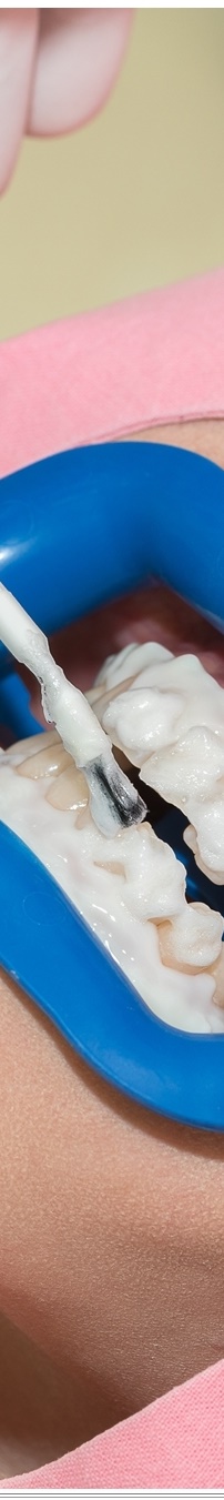 광화문역치과 생활습관에 따른 맞춤형 미백 관리 관련 이미지 20