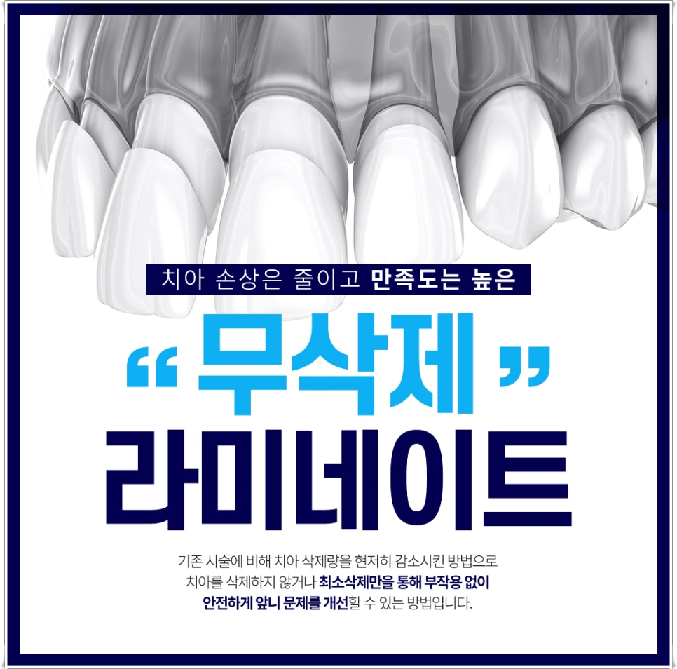 라미네이트 유지기간, 오래 사용하는 관리 방법 총정리 | 종로치과 관련 이미지 4