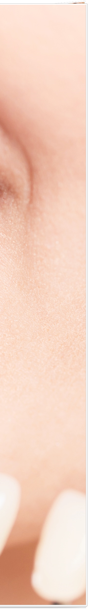 종로치과에서 알려드리는 치아미백과 라미네이트의 모든 것 관련 이미지 39