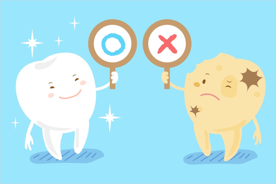 충치는 어떻게 생겨나는 것인가요? 관련 이미지 2