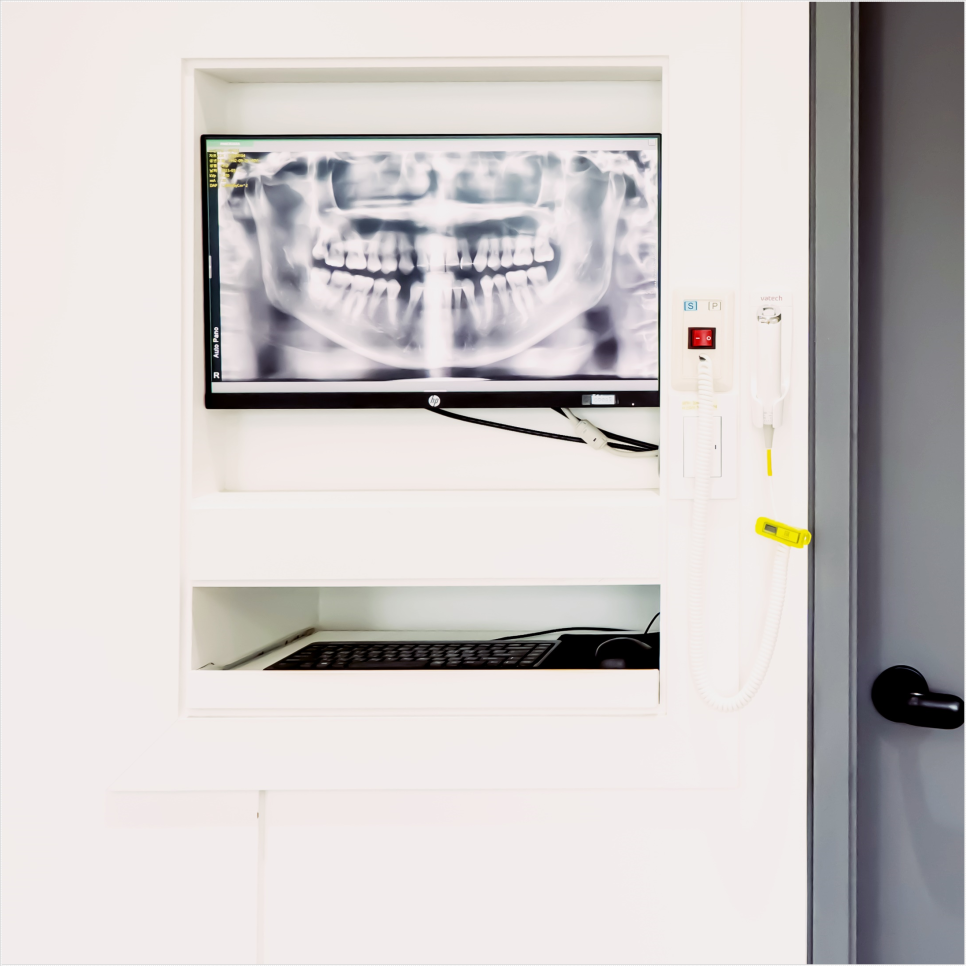 종로임플란트 시술 후 관리가 필요한 이유 관련 이미지 22