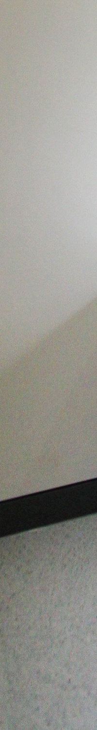 명동역치과 일상생활 중 치아가 흔들린다면 관련 이미지 19