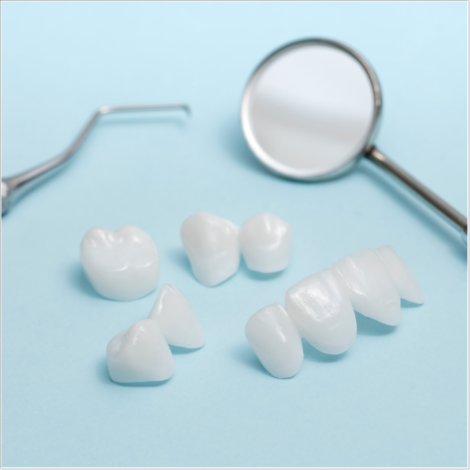 치아 변색 고민 끝, 을지로치과에서 듣는 라미네이트 사례 관련 이미지 20