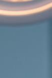Jongno Dental Implants: Fast and Accurate Treatment Using Digital Technology image 22
