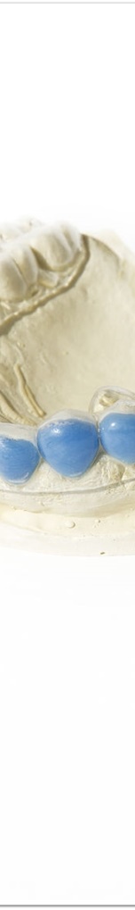 명동역치과 치아 미백, 궁금했던 모든 것 - 오해와 진실 관련 이미지 16