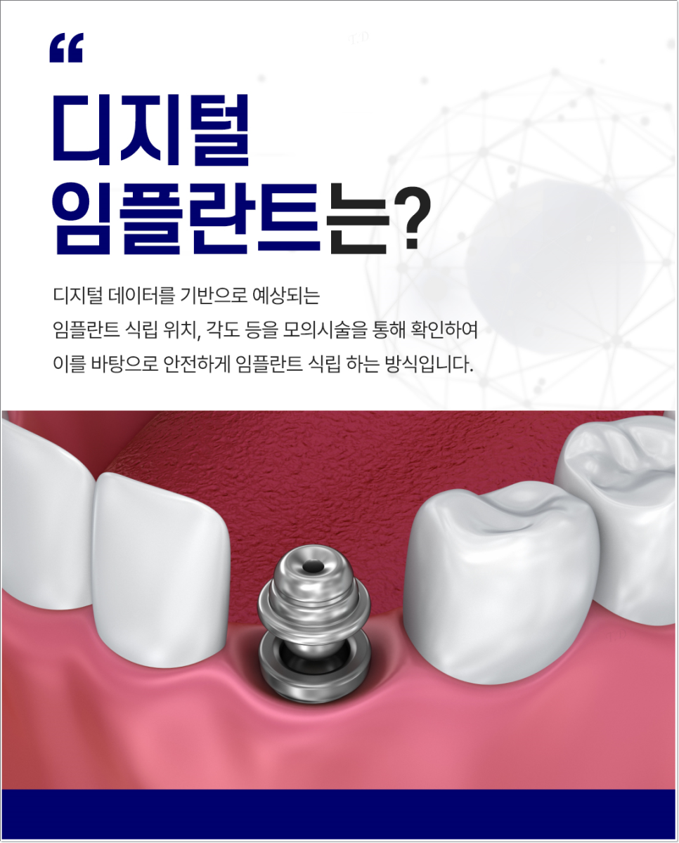 광화문역치과 치아 상실에 임플란트가 필요한 이유 관련 이미지 4