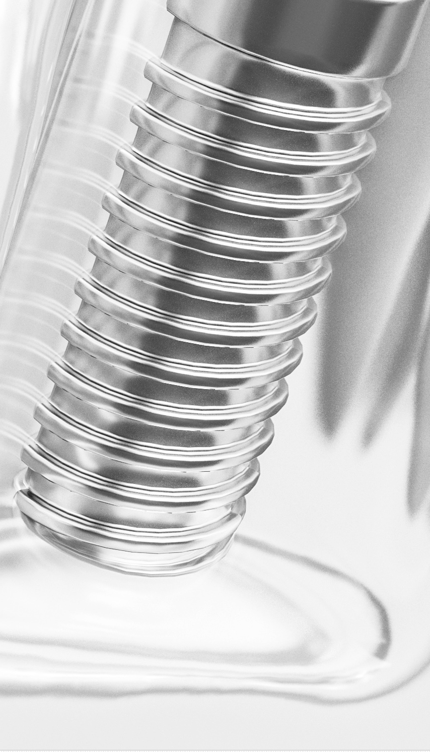 종각역치과 임플란트 치료, 이것만은 알고 계세요! 관련 이미지 21