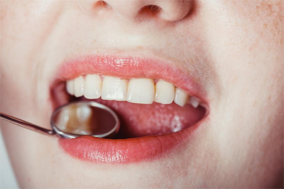 어린이 치아 관리에 신경 써 주세요 관련 이미지 4