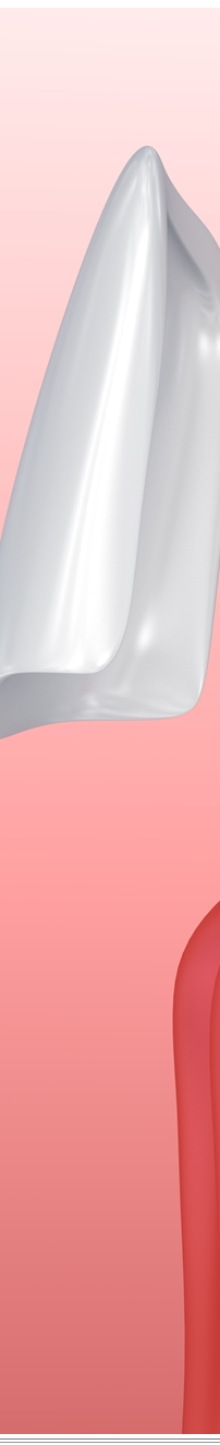 광화문역치과 치아미백과 라미네이트 나에게 필요한 건? 관련 이미지 7