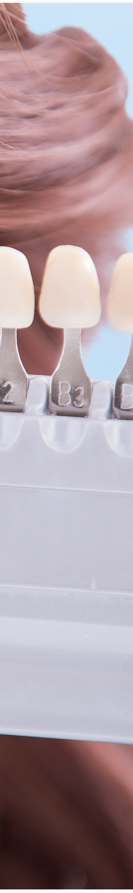 명동치과 라미네이트로 환하게 스마일~ 관련 이미지 16