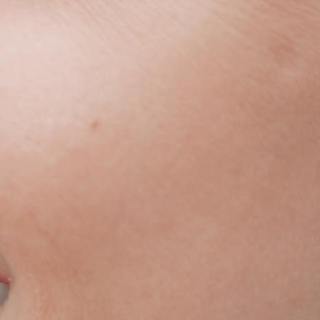 을지로입구치과 라미네이트 치료, 어디까지 알고 있나요? 관련 이미지 11