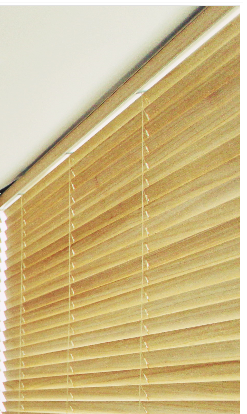 종로치과 인비절라인 해야 하는 이유 관련 이미지 25