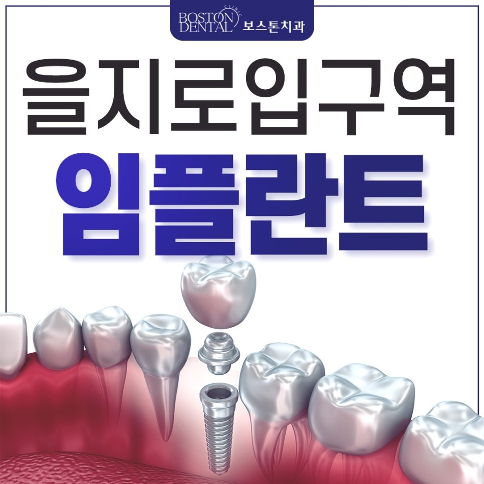 을지로입구역치과 3D 장비로 확인 후 정확하게 임플란트 식립 관련 이미지 1