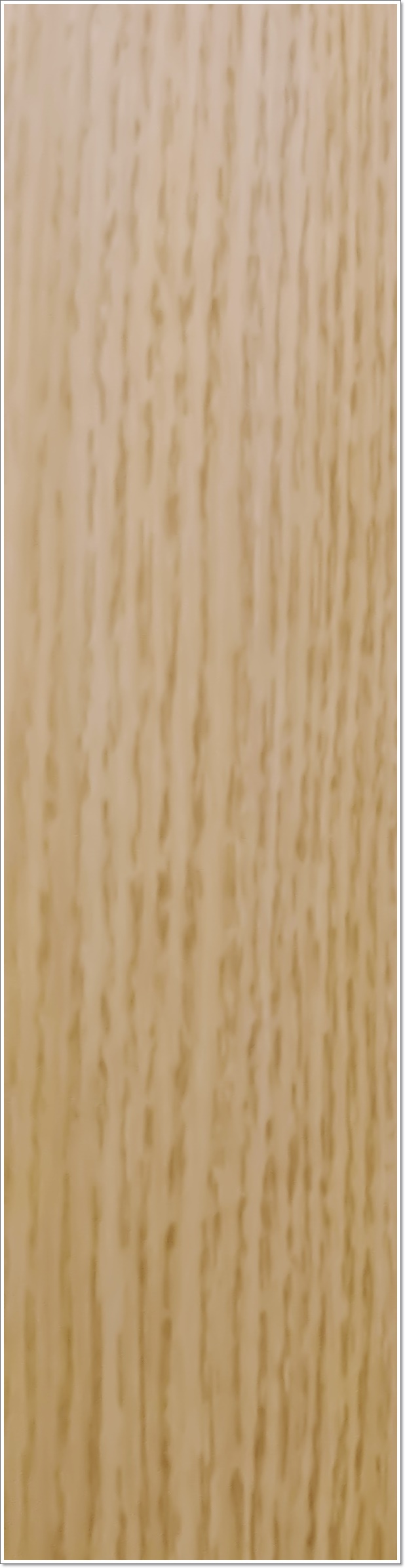 종각역치과 임플란트가 필요한 이유 관련 이미지 14