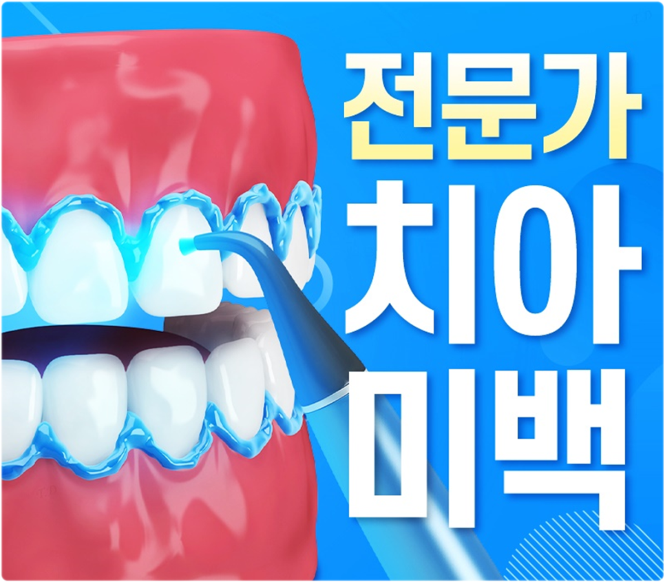 치아미백 부작용 없이 안전하게 하는 방법 | 광화문역치과 의료진 조언 관련 이미지 3