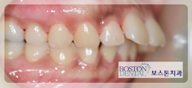 종각역치과추천 꼭 필요한 치료만! 관련 이미지 7