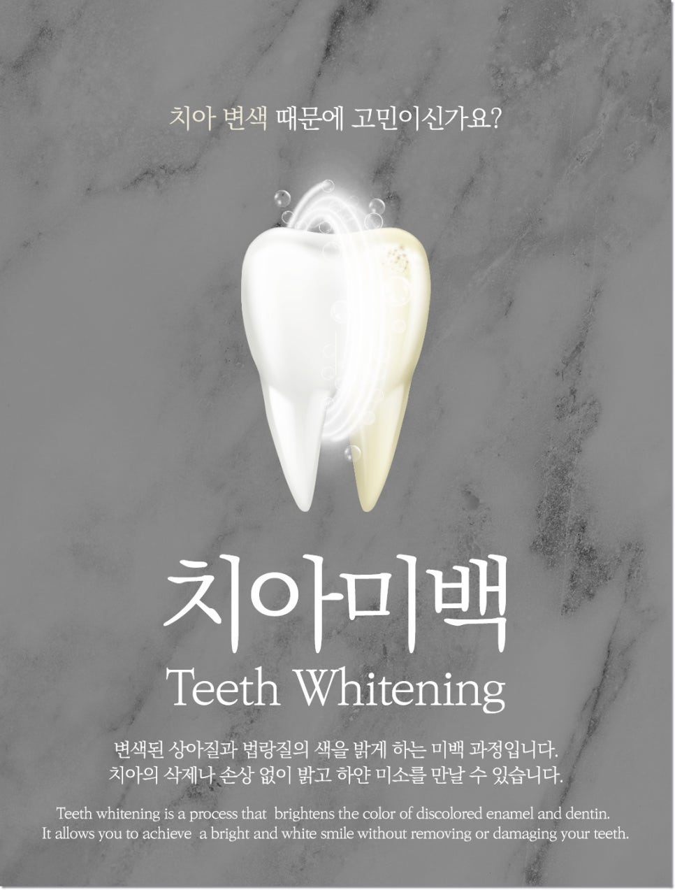 명동치과에서 알려드리는 치아미백, 전문가미백 차이점 관련 이미지 3