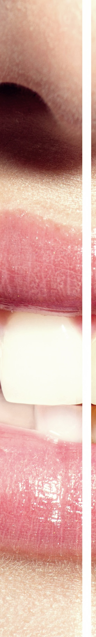 광화문역치과 치아미백과 라미네이트의 차이는? 관련 이미지 7