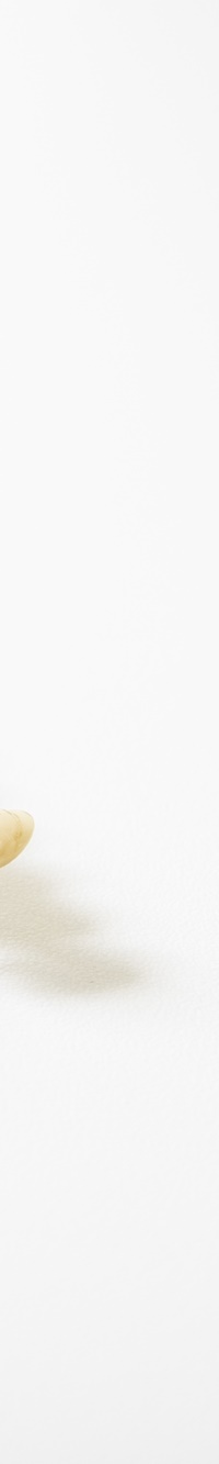 명동치과 주변 치아와 자연스러운 라미네이트 하는 방법 관련 이미지 17