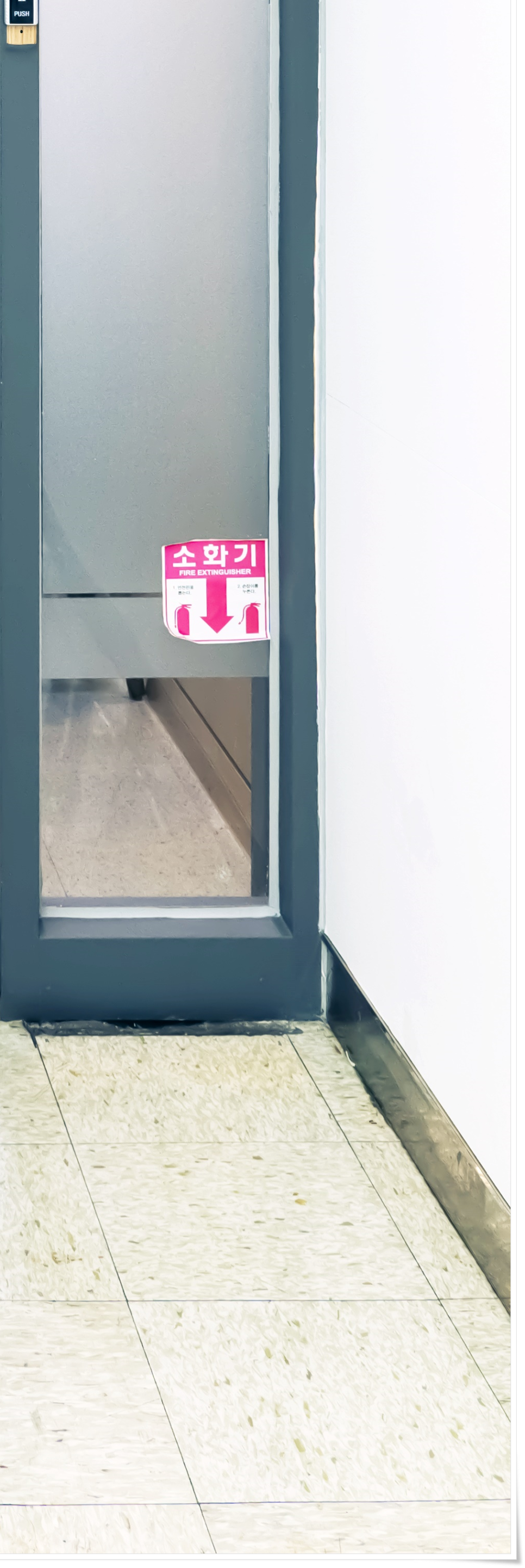 명동치과 저작력을 회복하기 위해서는? 관련 이미지 25