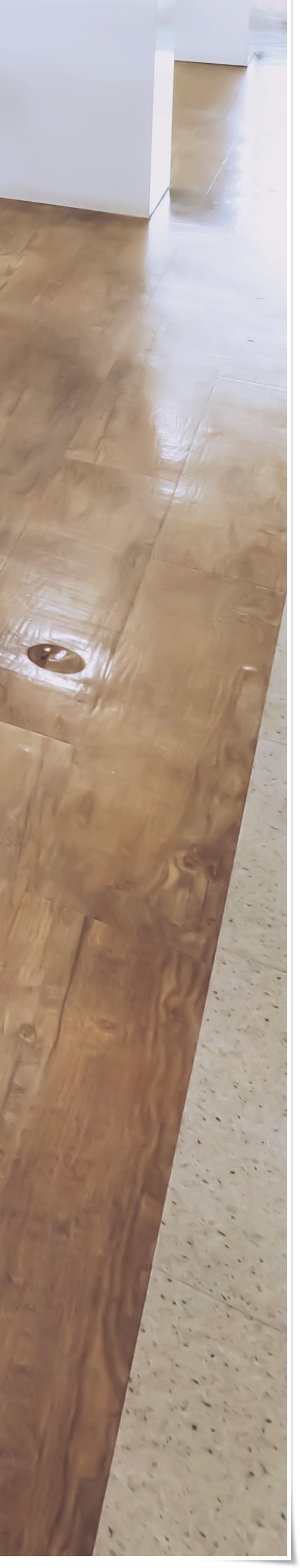 종로치과 올바른 자리에 식립을 합니다. 관련 이미지 48