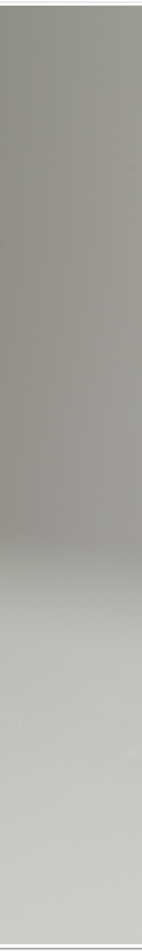 명동역치과 치아 미백, 궁금했던 모든 것 - 오해와 진실 관련 이미지 31