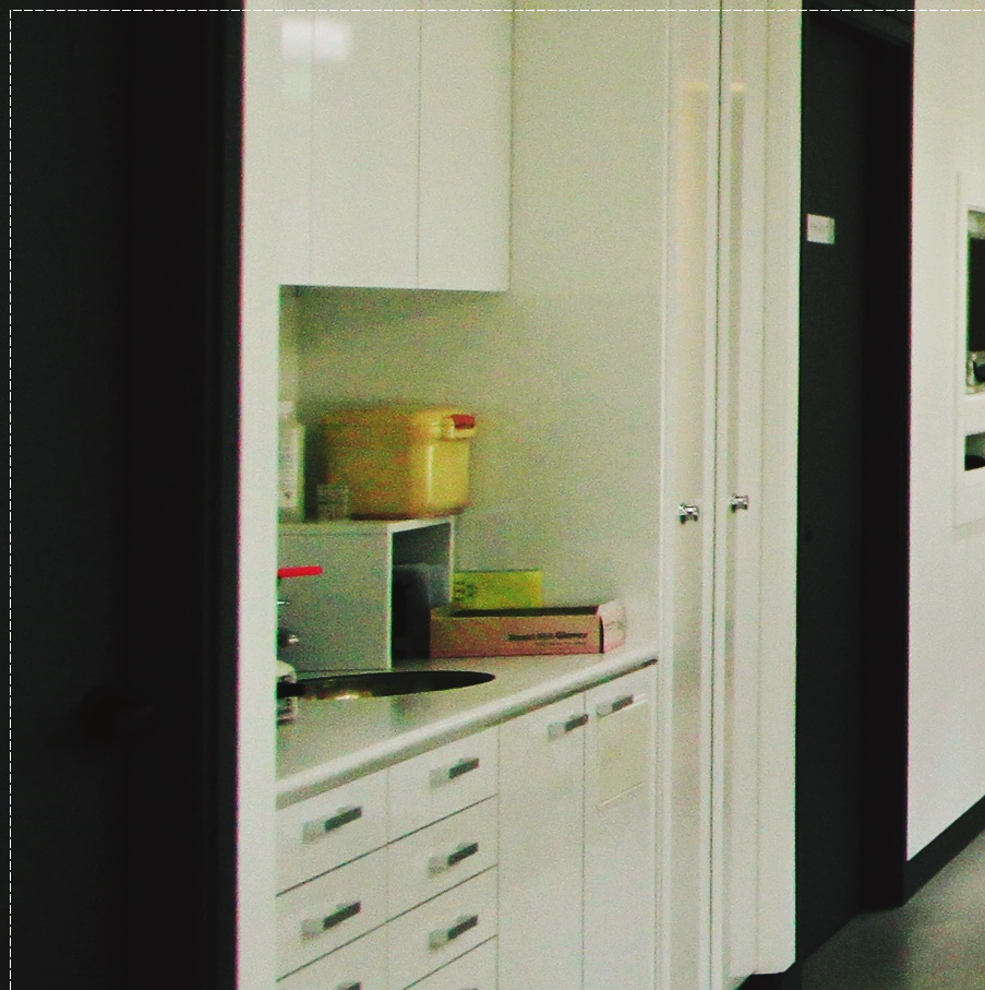 을지로치과 투명해서 티가 안 나게 교정할 수 있어요 관련 이미지 32