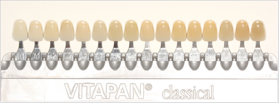 종로치과 치아미백 효과는 얼마나 지속될까? 관련 이미지 7