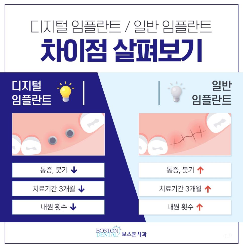 종로임플란트 첨단장비로 분석하여 식립 관련 이미지 5