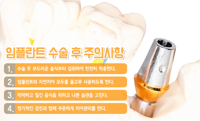 광화문임플란트 정확하게! 관련 이미지 3