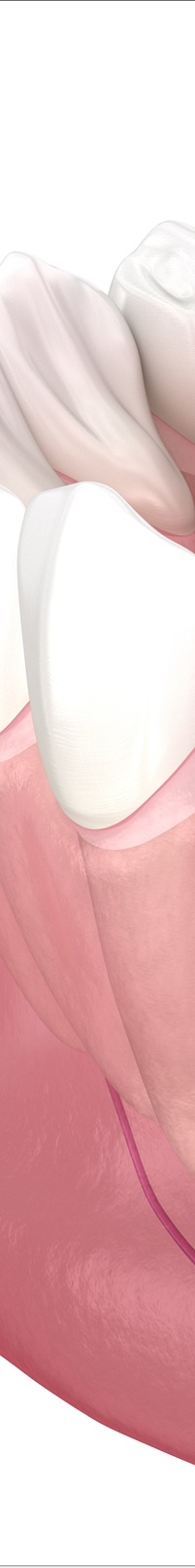 종각역치과 자연치아를 살리기 위한 대책, 신경치료 관련 이미지 10