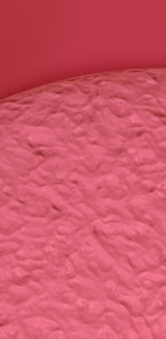 명동역치과 라미네이트 삭제된 치아는 다시 자라지 않습니다. 관련 이미지 34