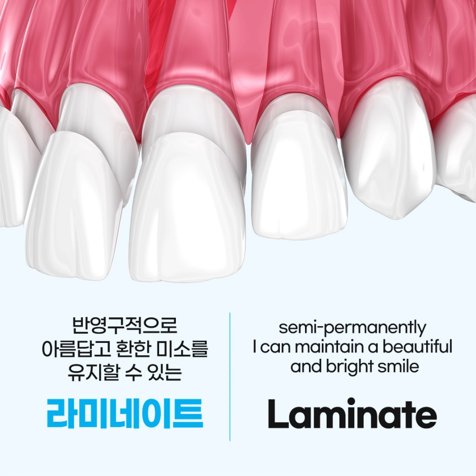 종로3가치과에서 알려드리는 무삭제 라미네이트 완벽 가이드 관련 이미지 4