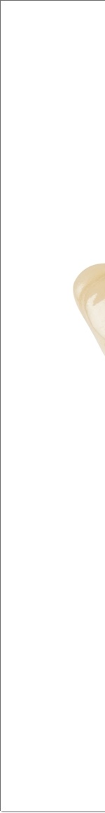 광화문치과 라미네이트 치료 전 고민해야 할 것 관련 이미지 3