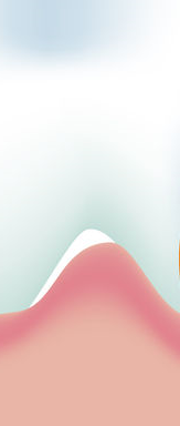 Cavity Treatment, Root Canal Treatment, and Essential Cavity Prevention Tips from a Jongno-gu Dental Clinic! image 26