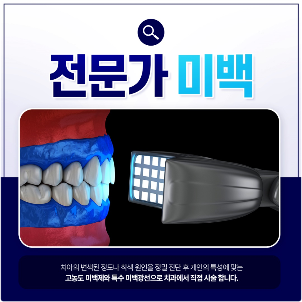치아미백 부작용 없이 안전하게 하는 방법 | 광화문역치과 의료진 조언 관련 이미지 4