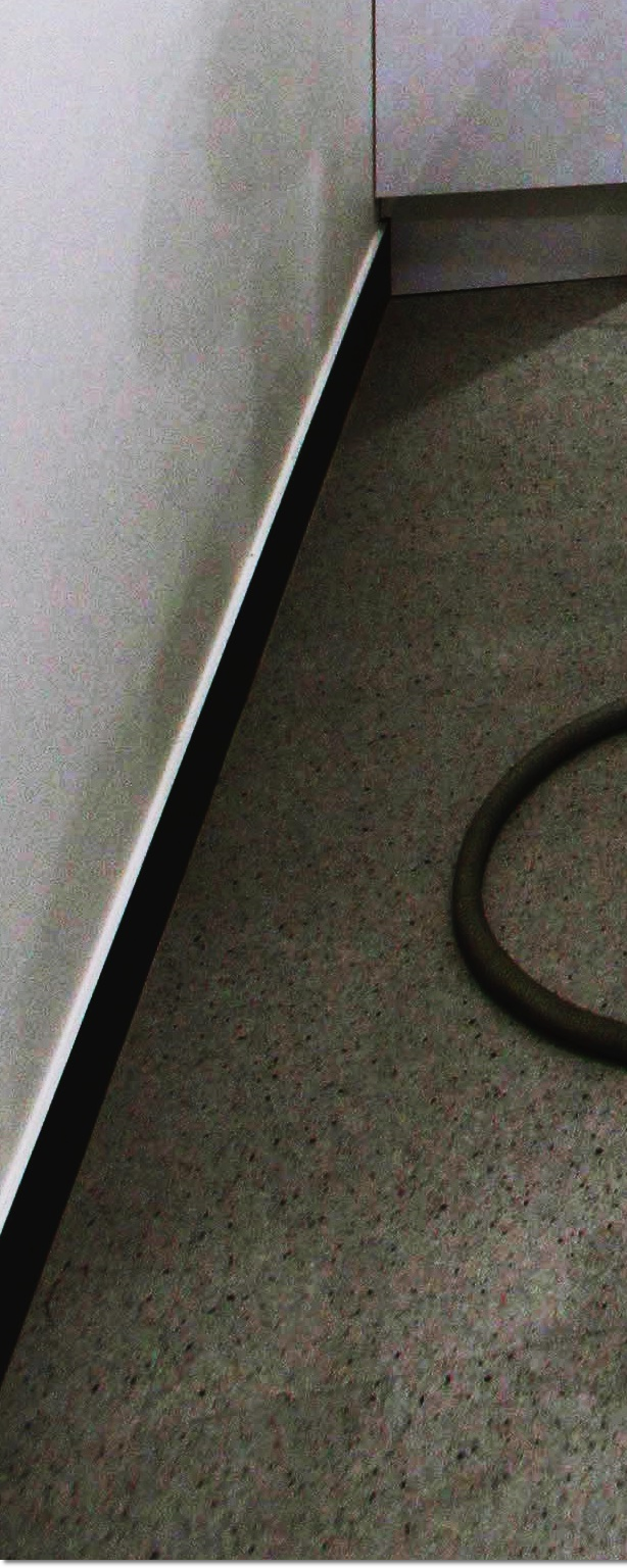 종각역치과 상실한 치아를 대체할 수 있는 방법 관련 이미지 23