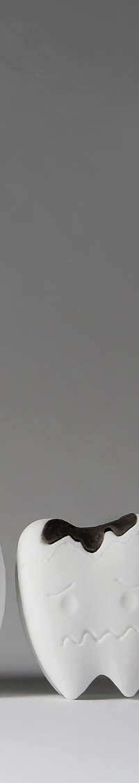 종로치과 충치치료는 조기 발견이 중요 관련 이미지 15