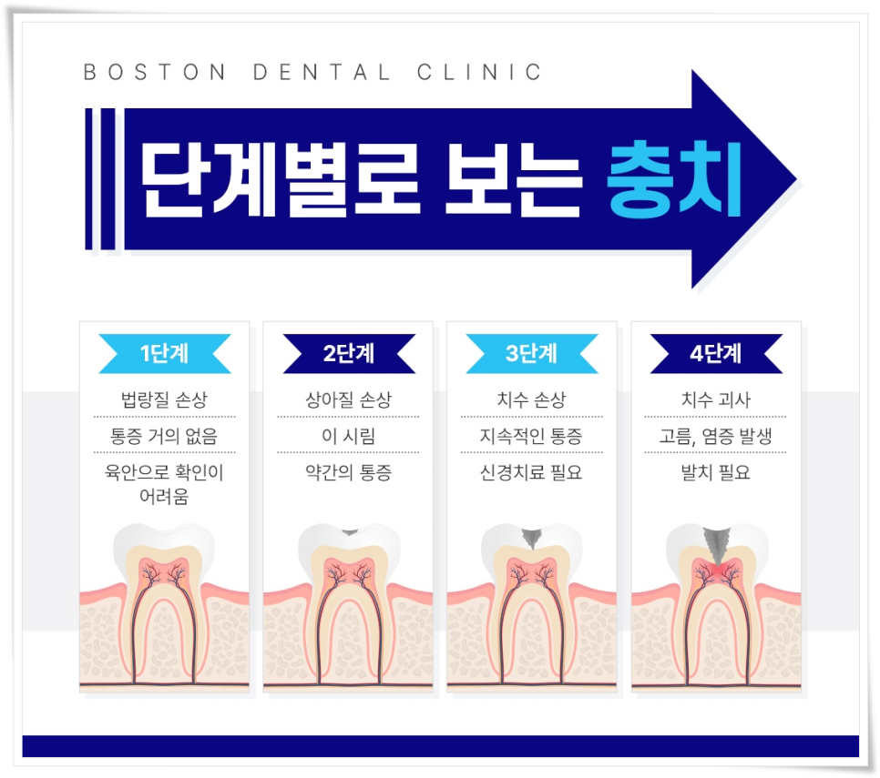 종로치과 수요일 8시까지 야간진료! 관련 이미지 3