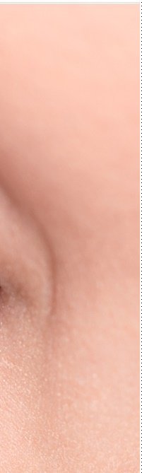 종로치과 라미네이트 주변 치아를 확인하여 자연스럽게 관련 이미지 16