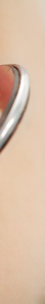 광화문치과 치아미백 그 후 관련 이미지 17