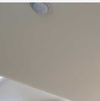 종각치과의 치아미백으로 하얀 미소 찾기 관련 이미지 15