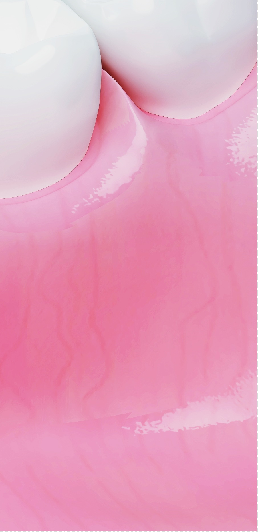 종각역치과 임플란트 치료, 이것만은 알고 계세요! 관련 이미지 45