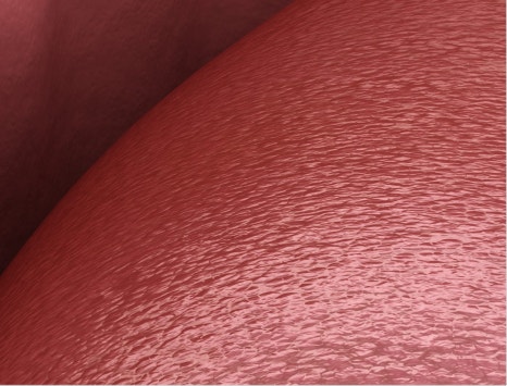 종로치과 충치가 생겼을 때 어떻게 치료 받아야 하나요? 관련 이미지 27