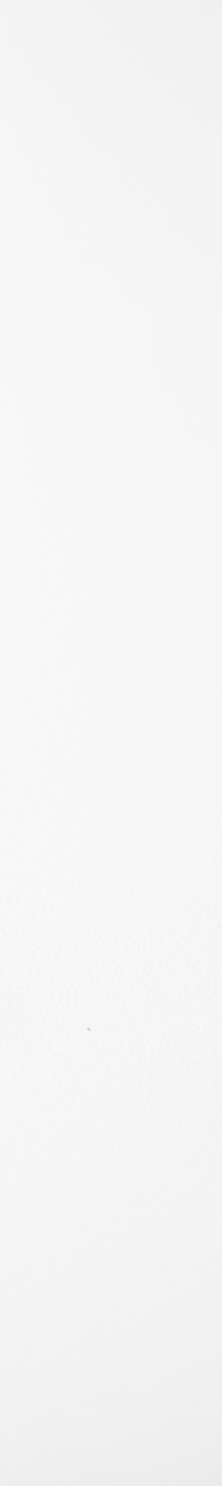 명동치과 주변 치아와 자연스러운 라미네이트 하는 방법 관련 이미지 18