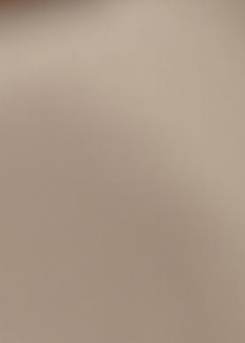 Laminate Veneers Explained by Jonggak Station Dental Clinic: Treatment Duration, Candidates, Benefits, and Everyday Changes image 38
