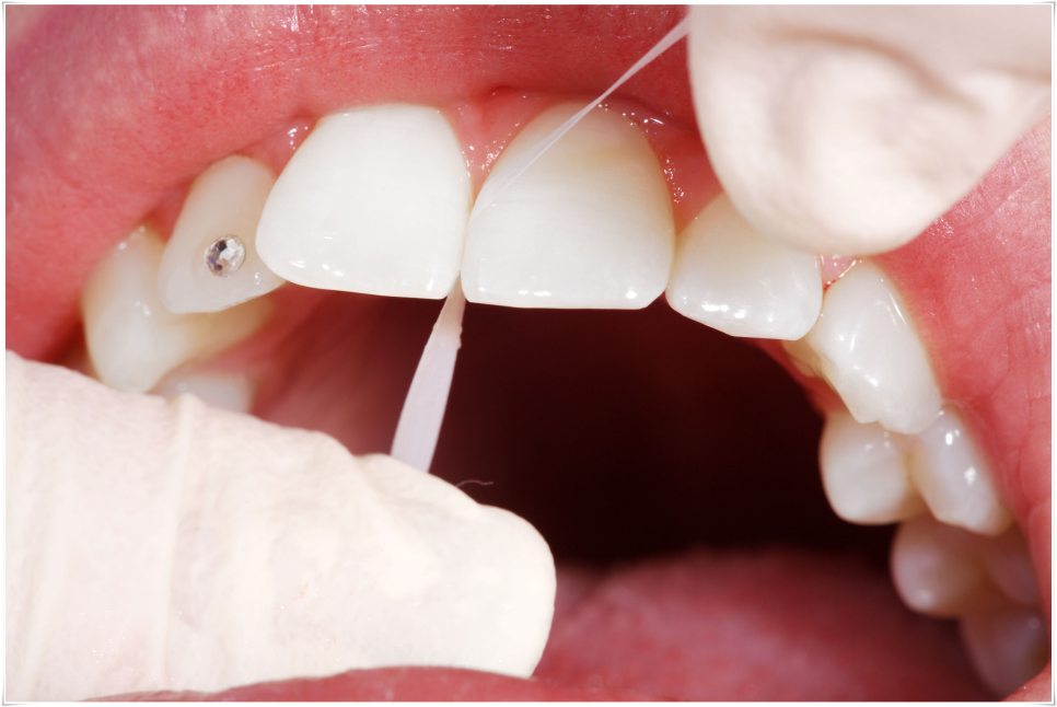 치실 올바르게 사용하고 있나요? 관련 이미지 1