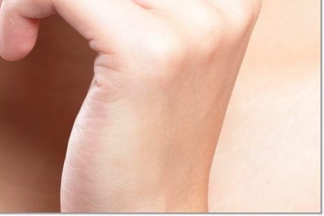 명동치과에서 알아보는 치아미백의 모든 것 관련 이미지 27